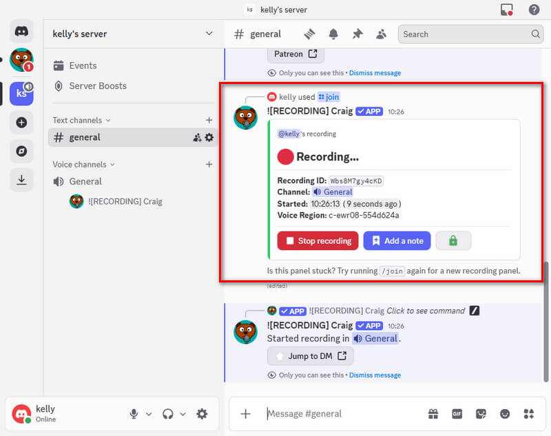 start and end the audio recording